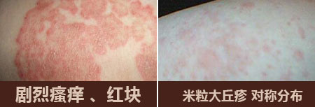 南京皮肤医院引起皮炎湿疹疾病出现的原因有哪些 ？