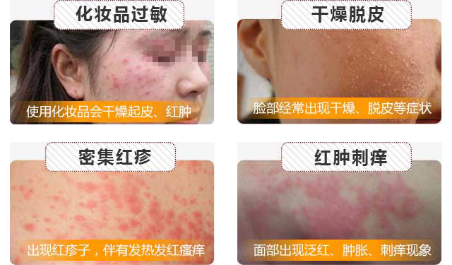 南京肤康皮肤医院皮肤瘙痒是由什么引起的