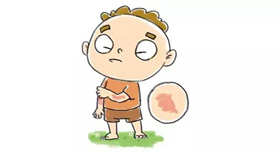 南京肤康皮肤医院过敏性皮炎患者有哪些注意事项呢？